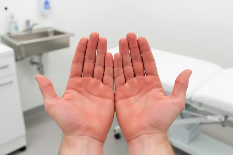 Etwa 70 Prozent der Patientinnen und Patienten mit primär biliärer Cholangitis berichten von starkem Juckreiz als Leitsymptom