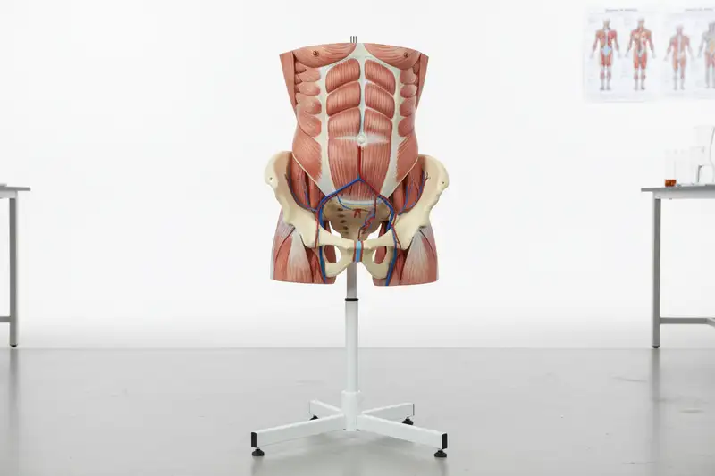 Etwa 20 Millionen Leistenbrüche werden weltweit pro Jahr operiert